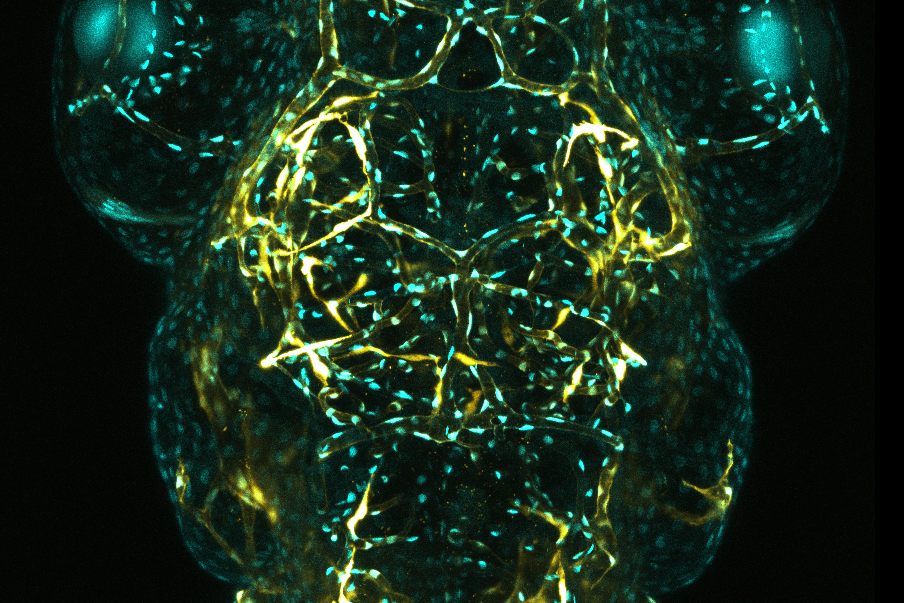 Cerebral Vessels in Zebrafish