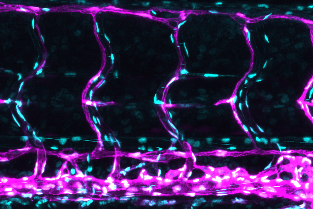 The zebrafish trunk vessel network