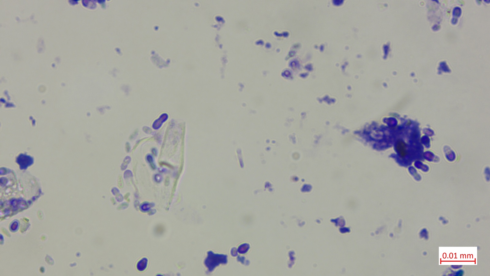 Cytology ear discharge identifying yeast and bacteria infection