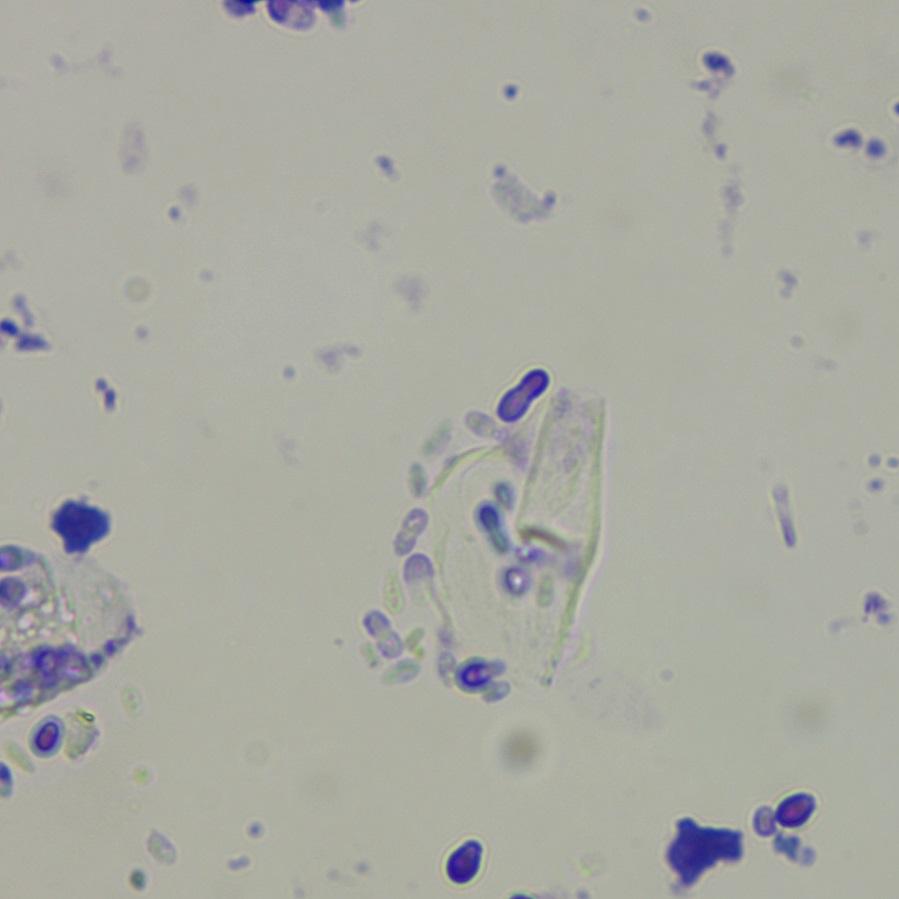 Cytology ear discharge identifying yeast and bacteria infection