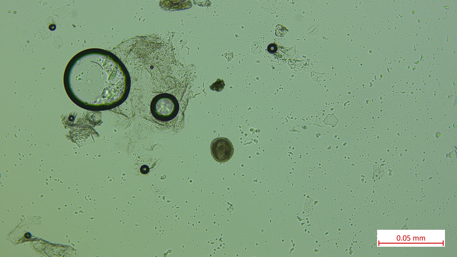 Fecal flotation identifying a roundworm egg