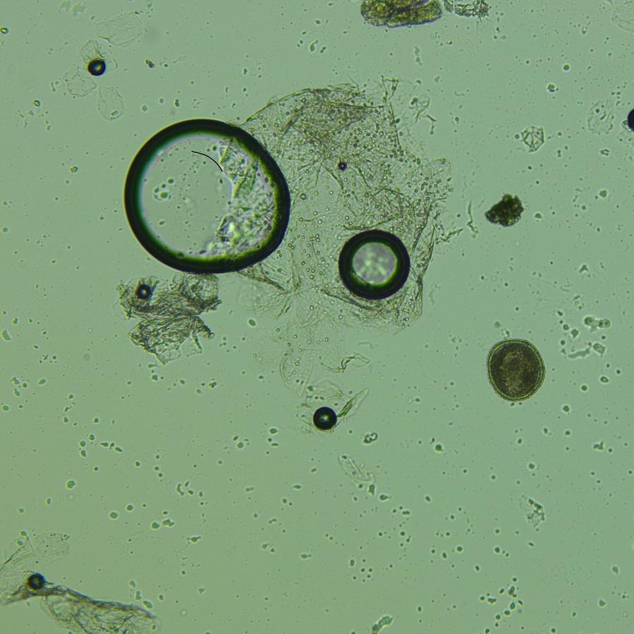 Fecal flotation identifying a roundworm egg