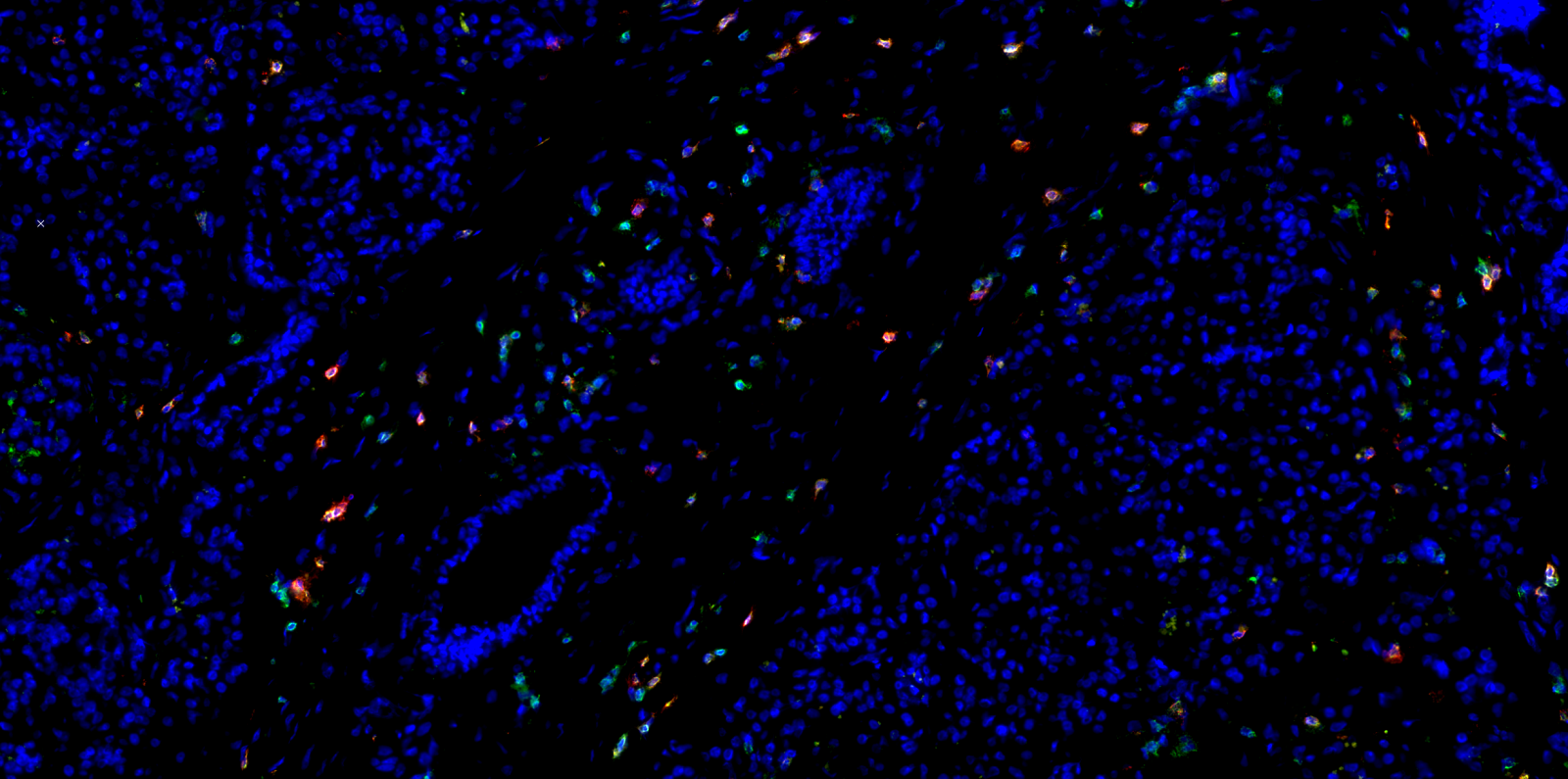 Pancreas Pathology | Axioscan