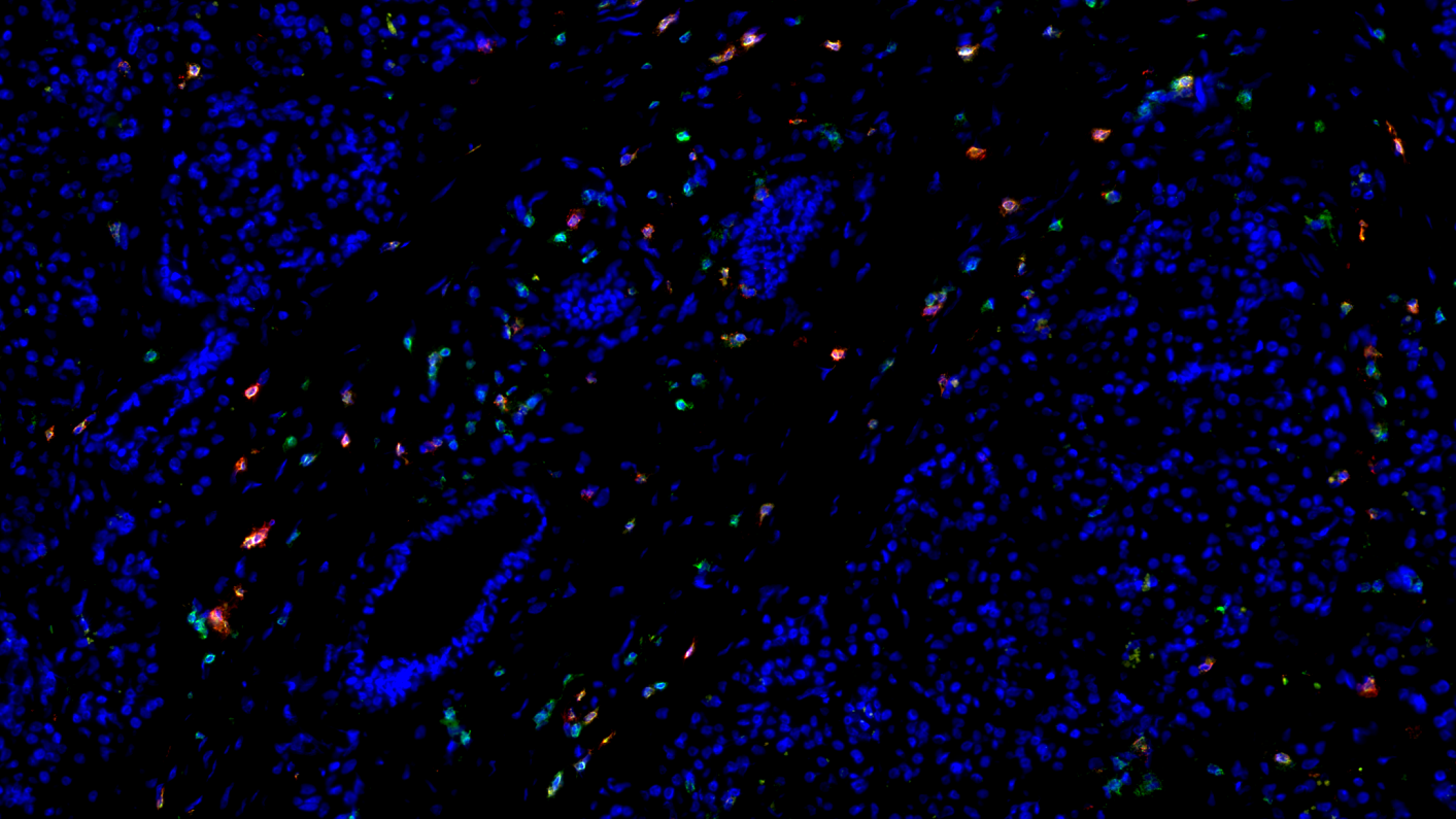 Whole Slide Imaging of the Pancreas to Study Type 1 Diabetes