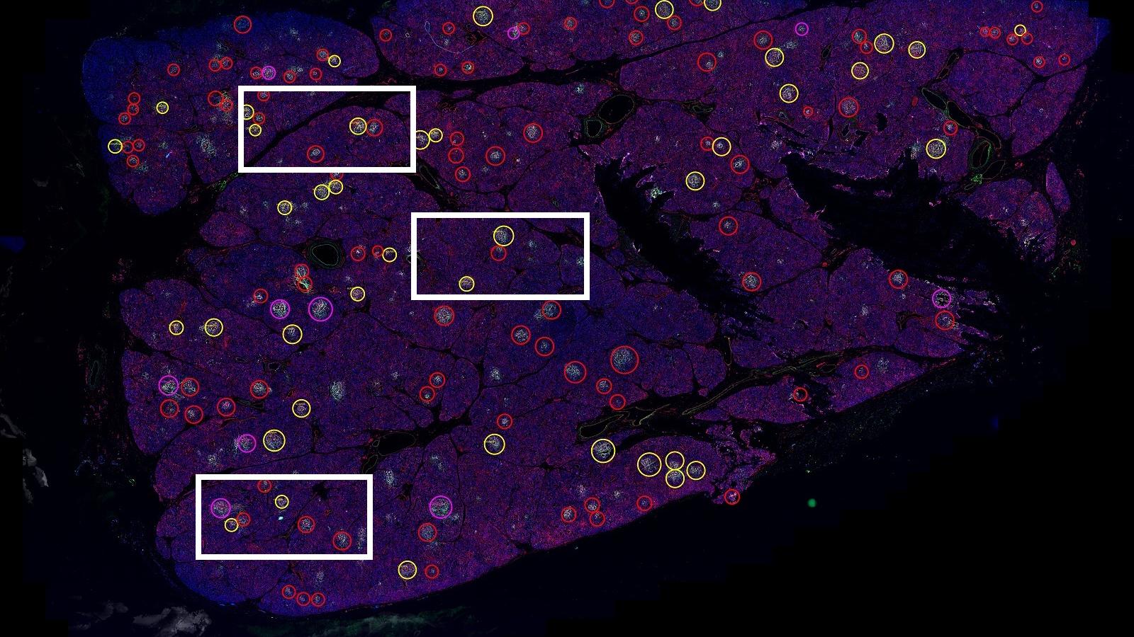 Whole Slide Imaging of the Pancreas to Study Type 1 Diabetes