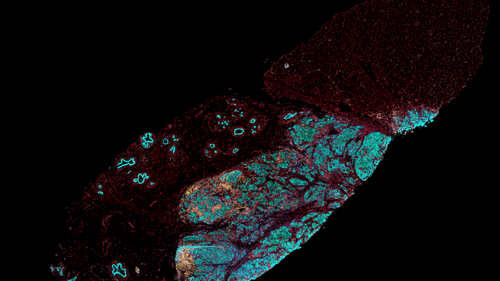 7 Color Multiplex Immunofluorescence for Spatial Biology with a