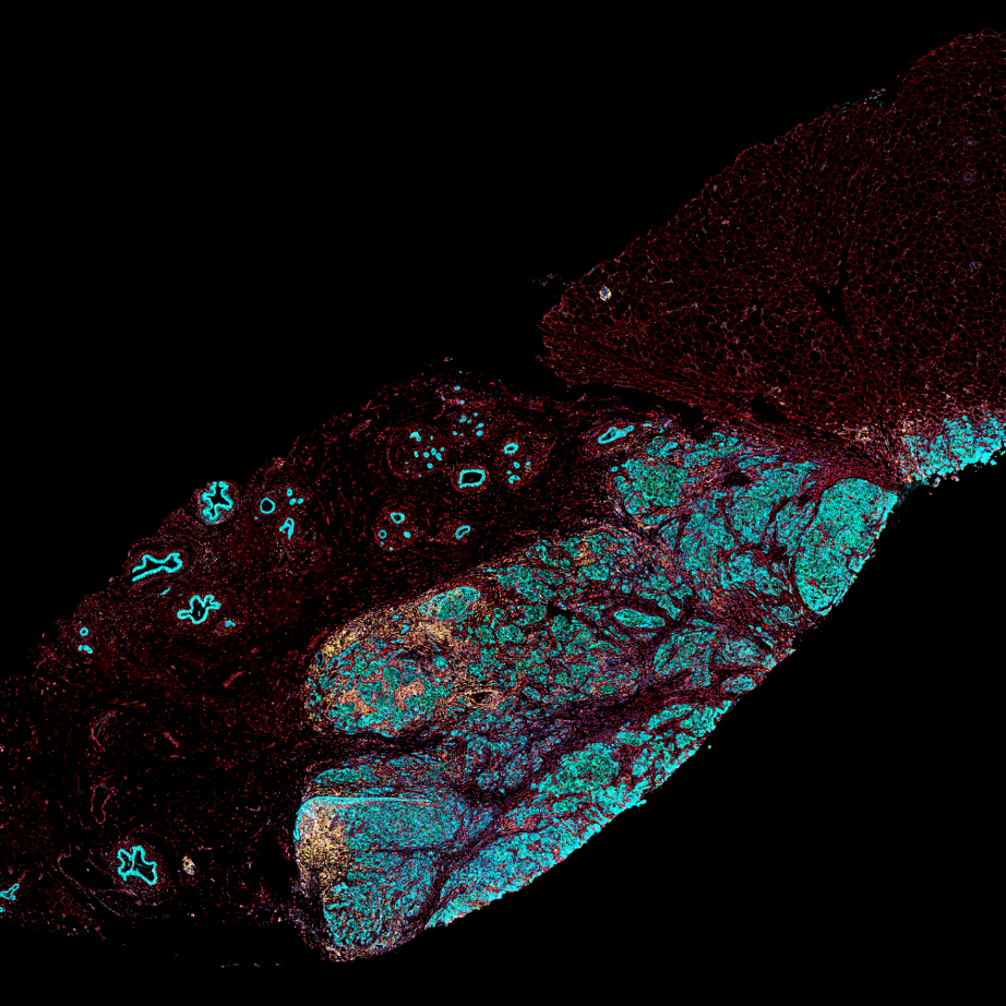 顕さま参考画像 7 Color Multiplex Immunofluorescence for Spatial Biology with a