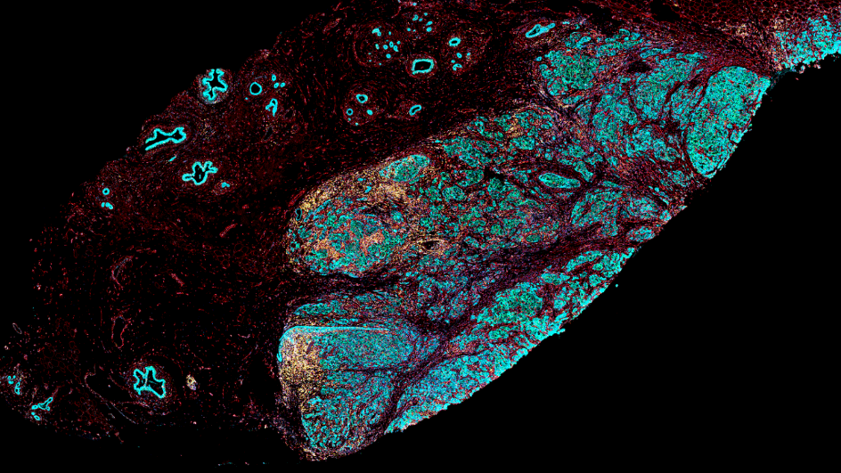 Multiplex immunofluorescence for spatial biology with a slide scanner