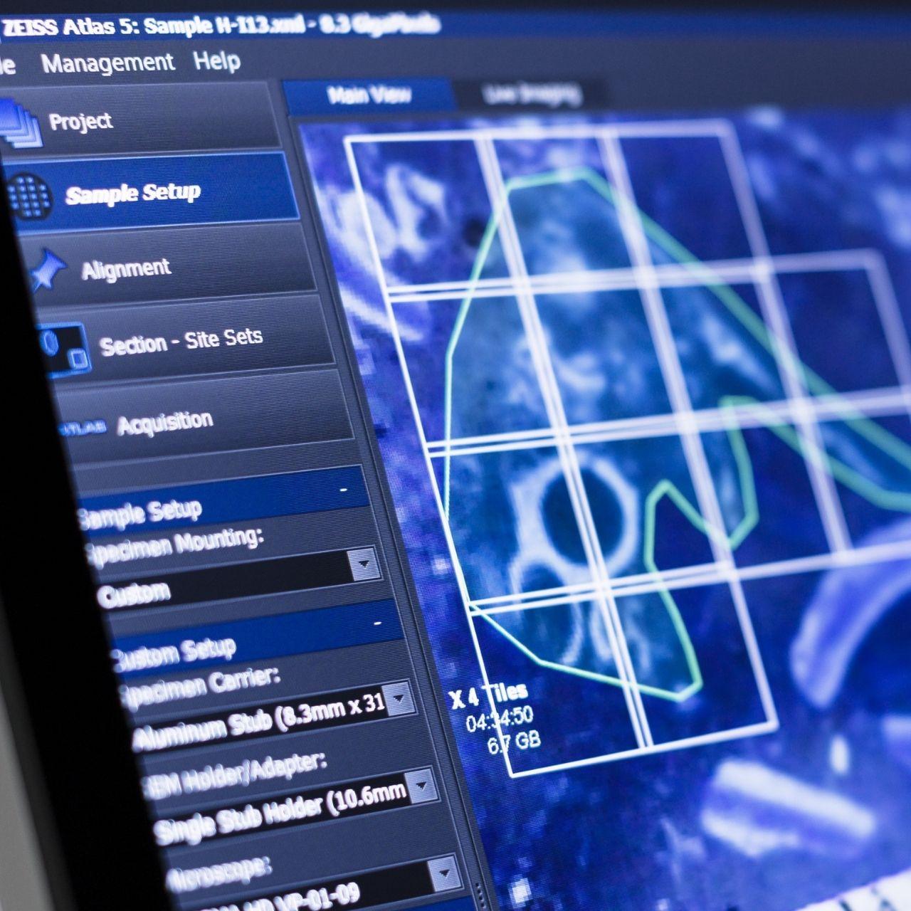 Close-up of a computer screen displaying ZEISS Atlas 5 interface with highlighted grid lines and imaging data from a scientific project.