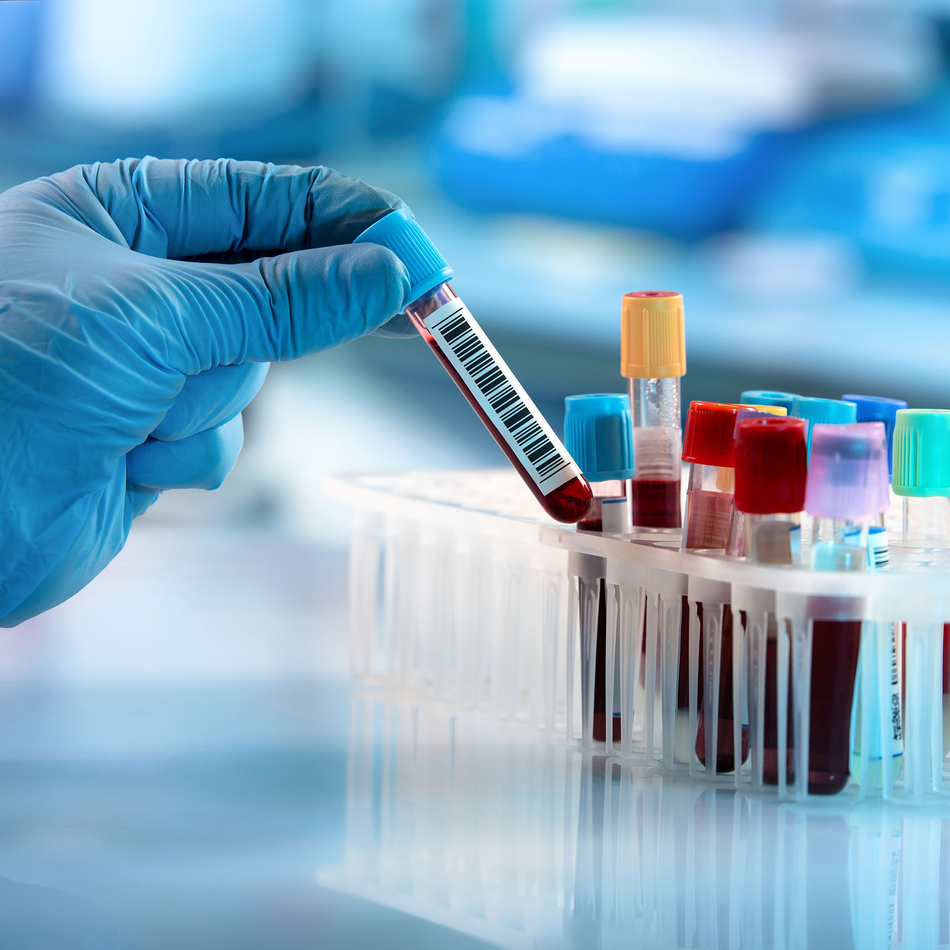 Technician holding blood tube test in the research laboratory / doctor hand taking a blood sample tube from a rack with machines of analysis in the lab background