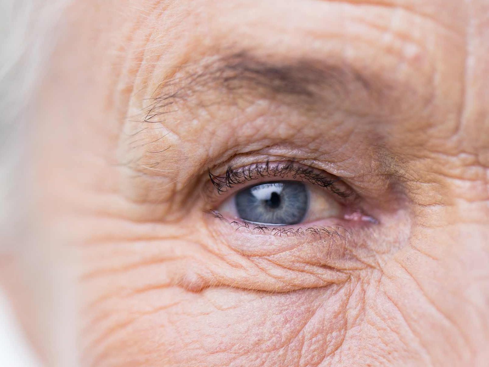 The image shows a close-up of an unhealthy eye, illustrating potential ocular adnexa hazards. 