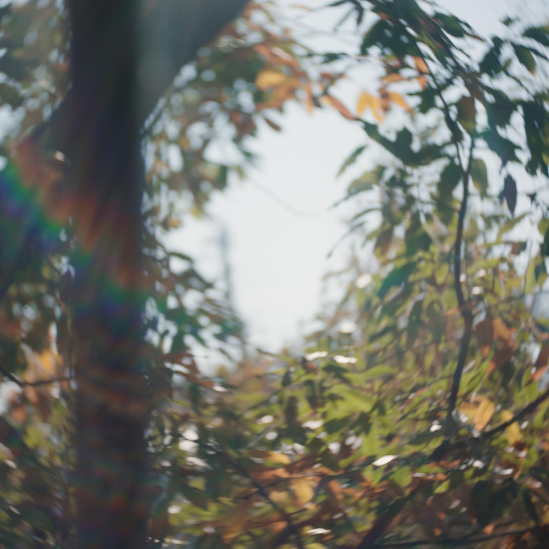 Blurred outdoor image of trees and sunlight, simulating vision affected by an uncorrected refractive error.