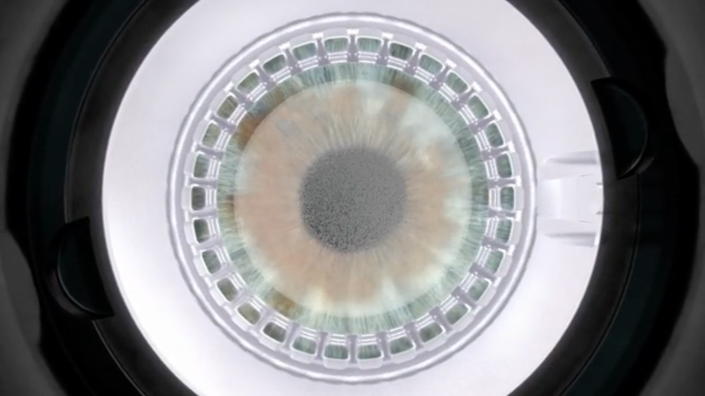 A close-up, top-down digital rendering of an eye during the procedure with ZEISS SMILE pro. The laser is precisely focused on the cornea to begin creating the lenticule. This moment visually highlights the minimally invasive, flapless nature of lenticule extraction with ZEISS SMILE pro. 