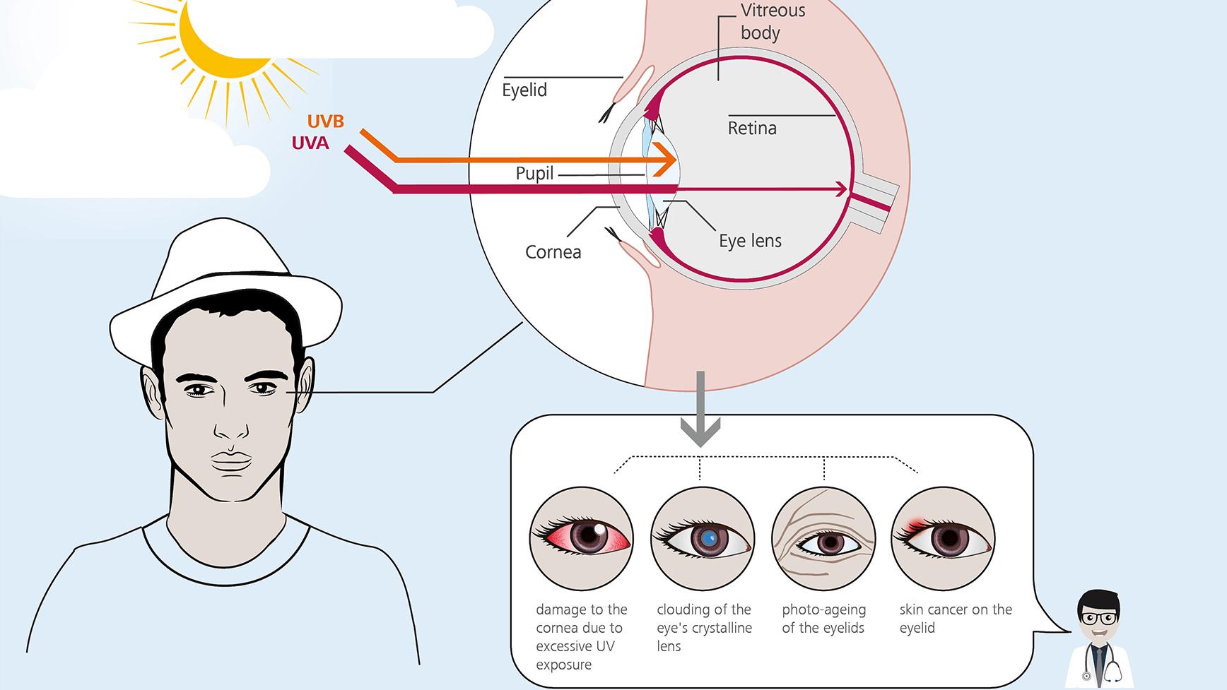 What You Should Know about UV Rays and Healthy Eyes