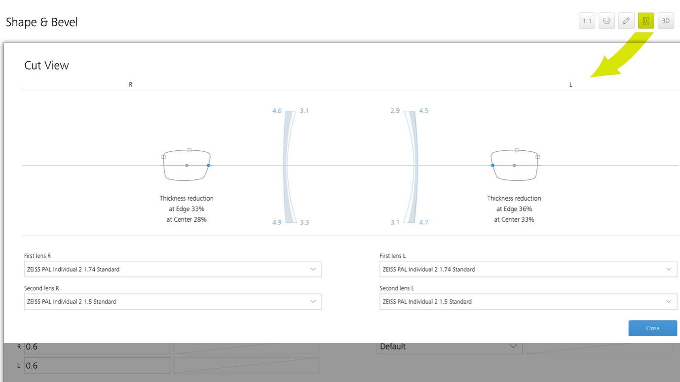 ZEISS VISUSTORE - cut view