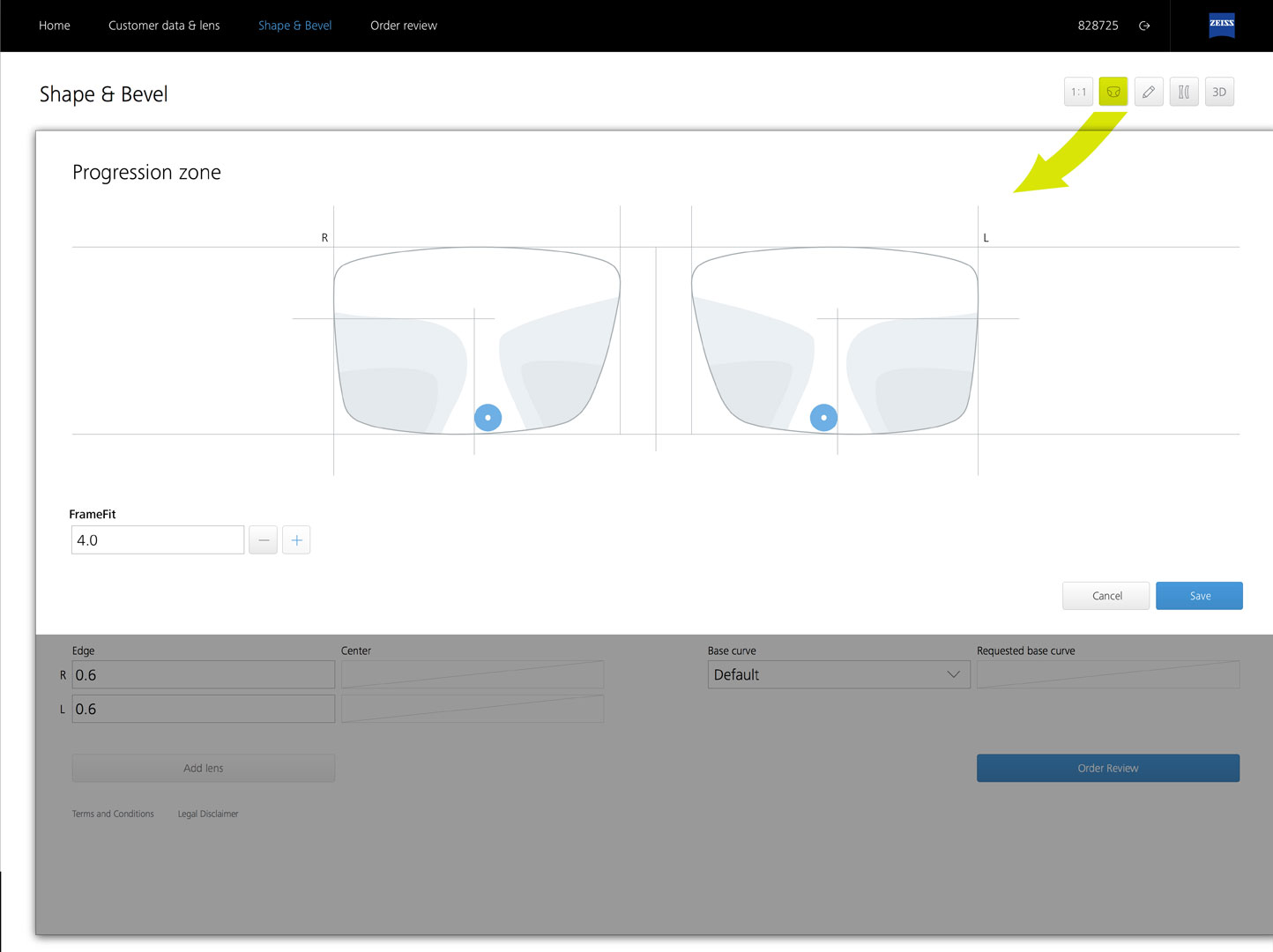 ZEISS VISUSTORE - progression zone