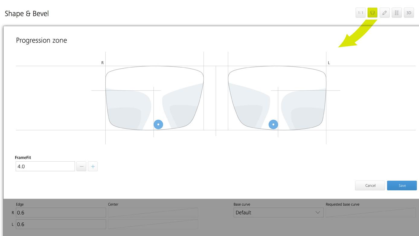 ZEISS VISUSTORE - progression zone