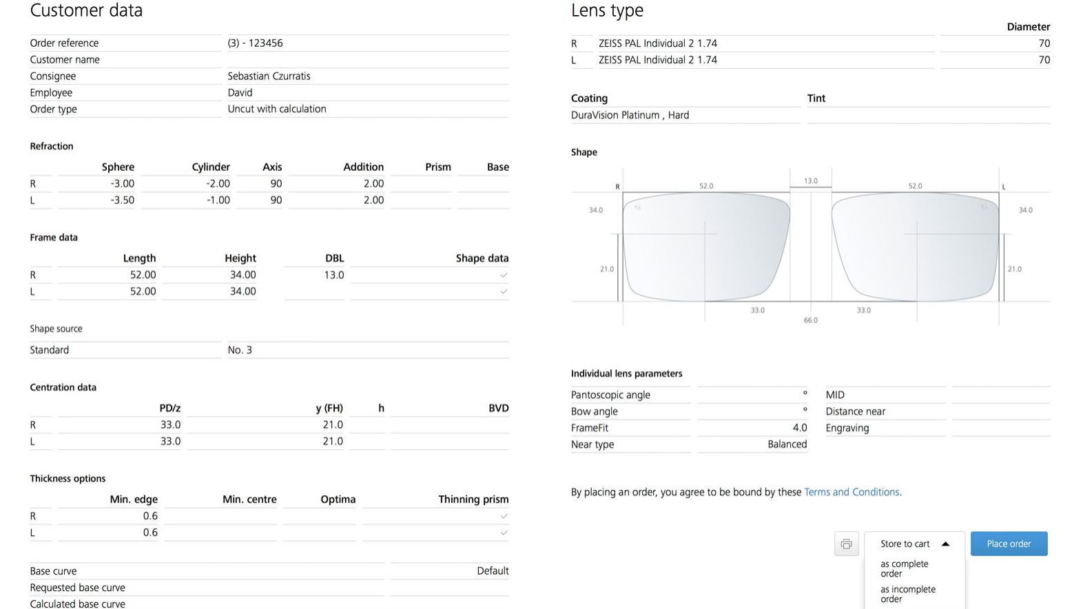 ZEISS VISUSTORE - order review