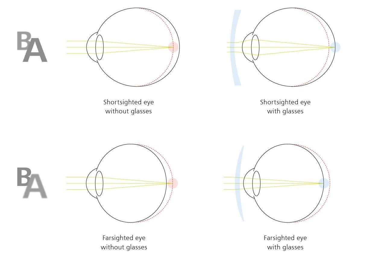 How ZEISS VISION CENTER Professionally Organize Every Step of the Eyeglass Purchase Process