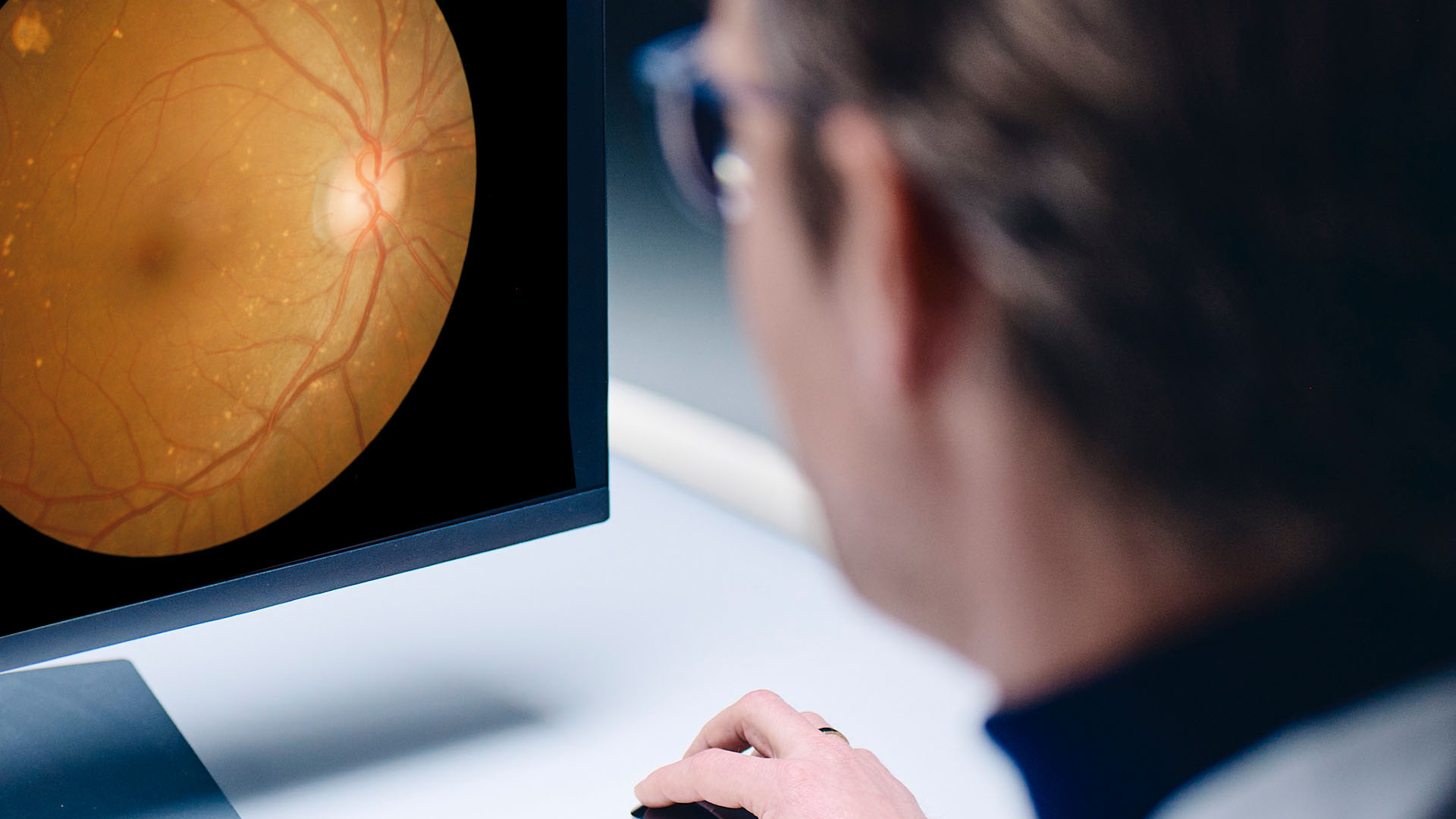 Expert screening an eye