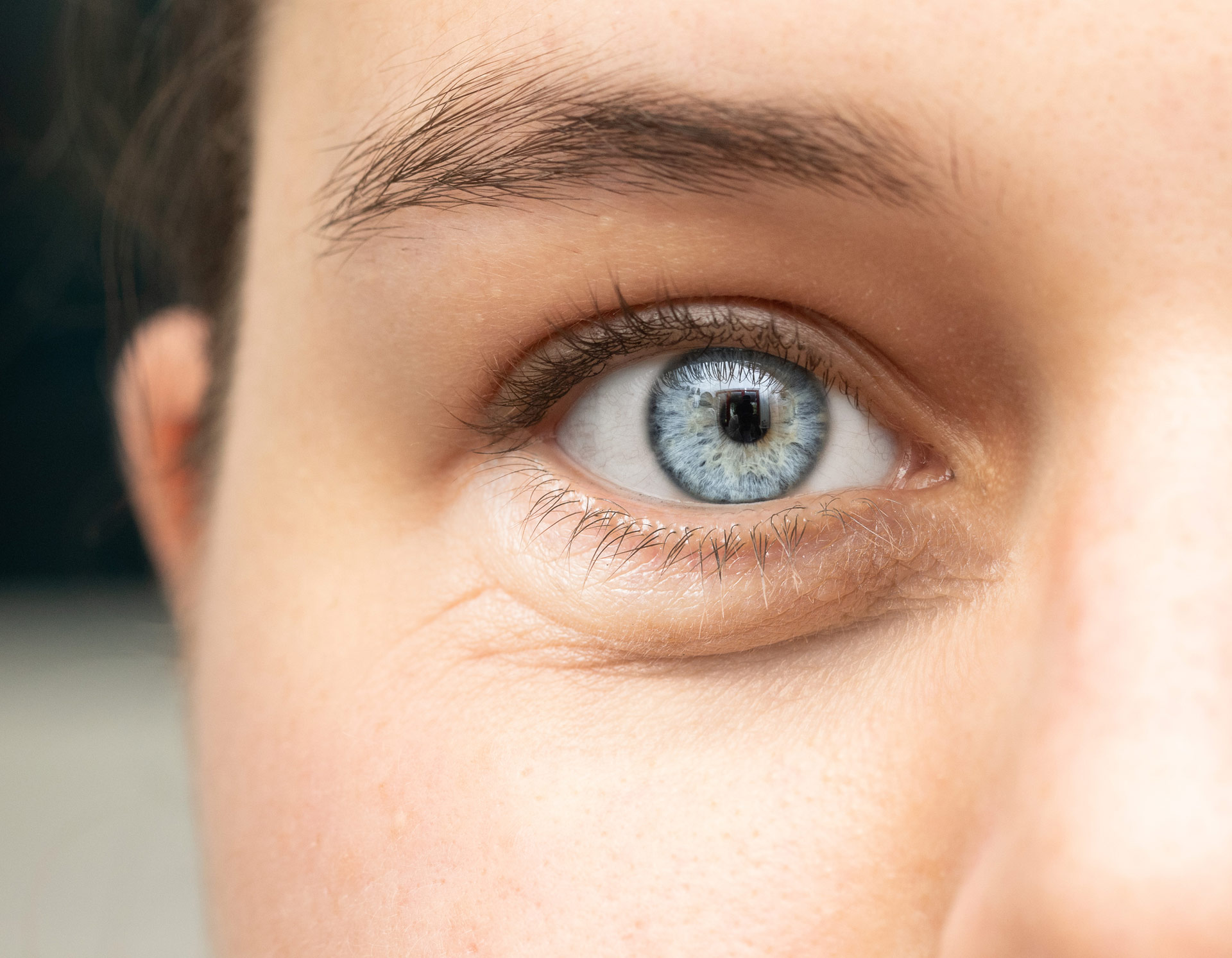 People Whose Eyes Have A Dark Ring Around The Iris Appear More Attractive,  Study Says
