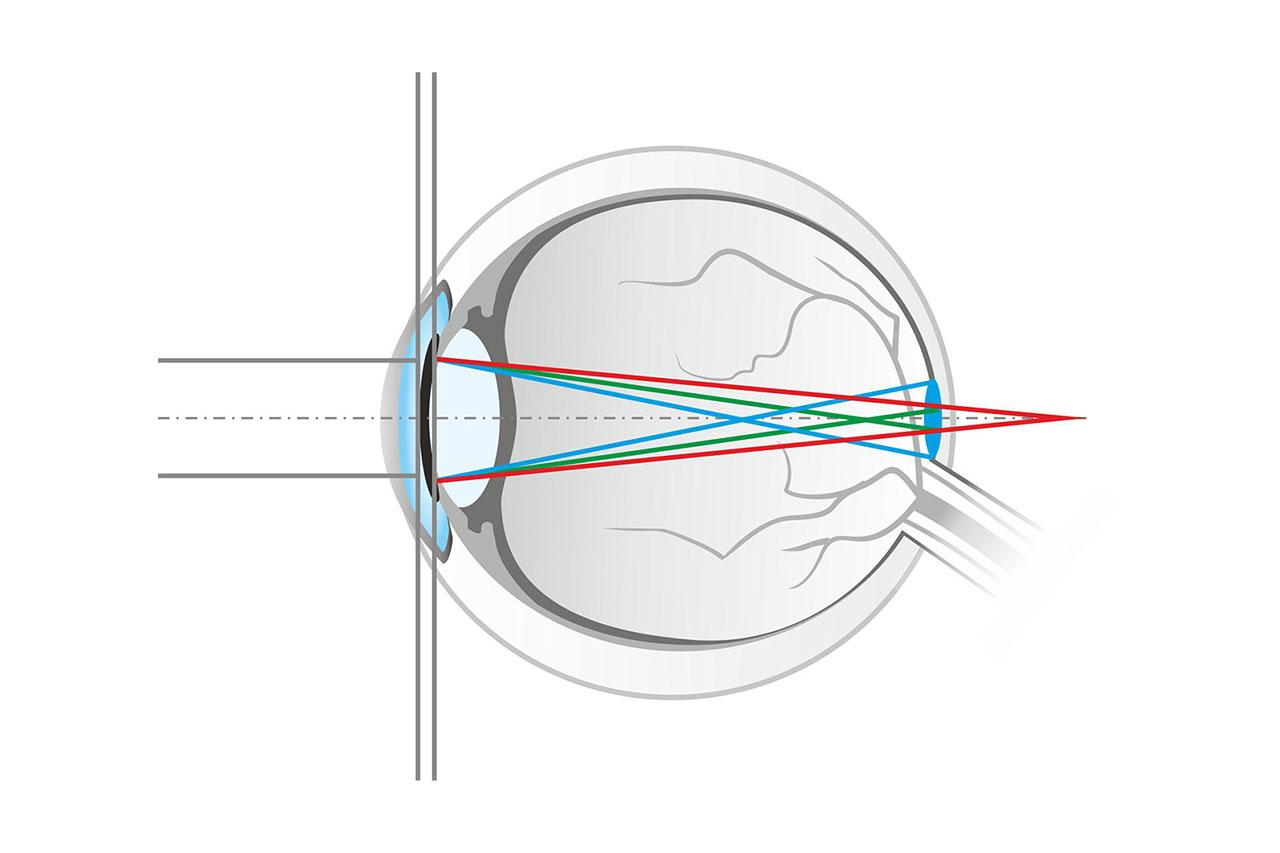 Clear spectacle lenses with a blue light filter