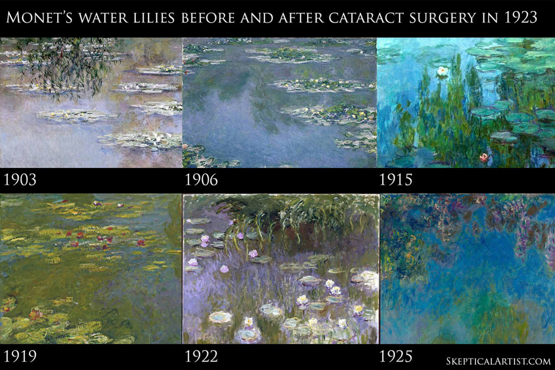 The absence of detail in Monet’s paintings during his period with cataracts is evident in these images.