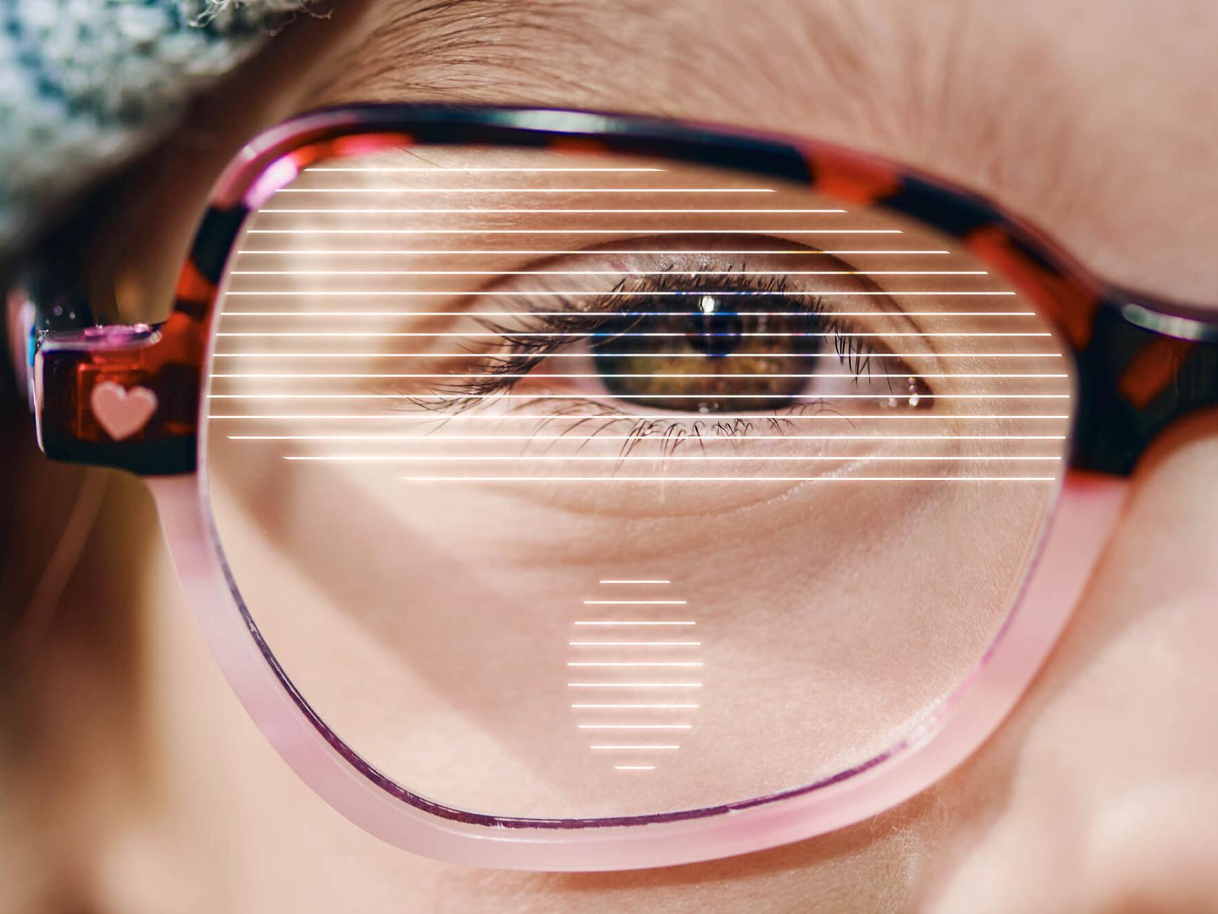 Severe myopia glasses sale