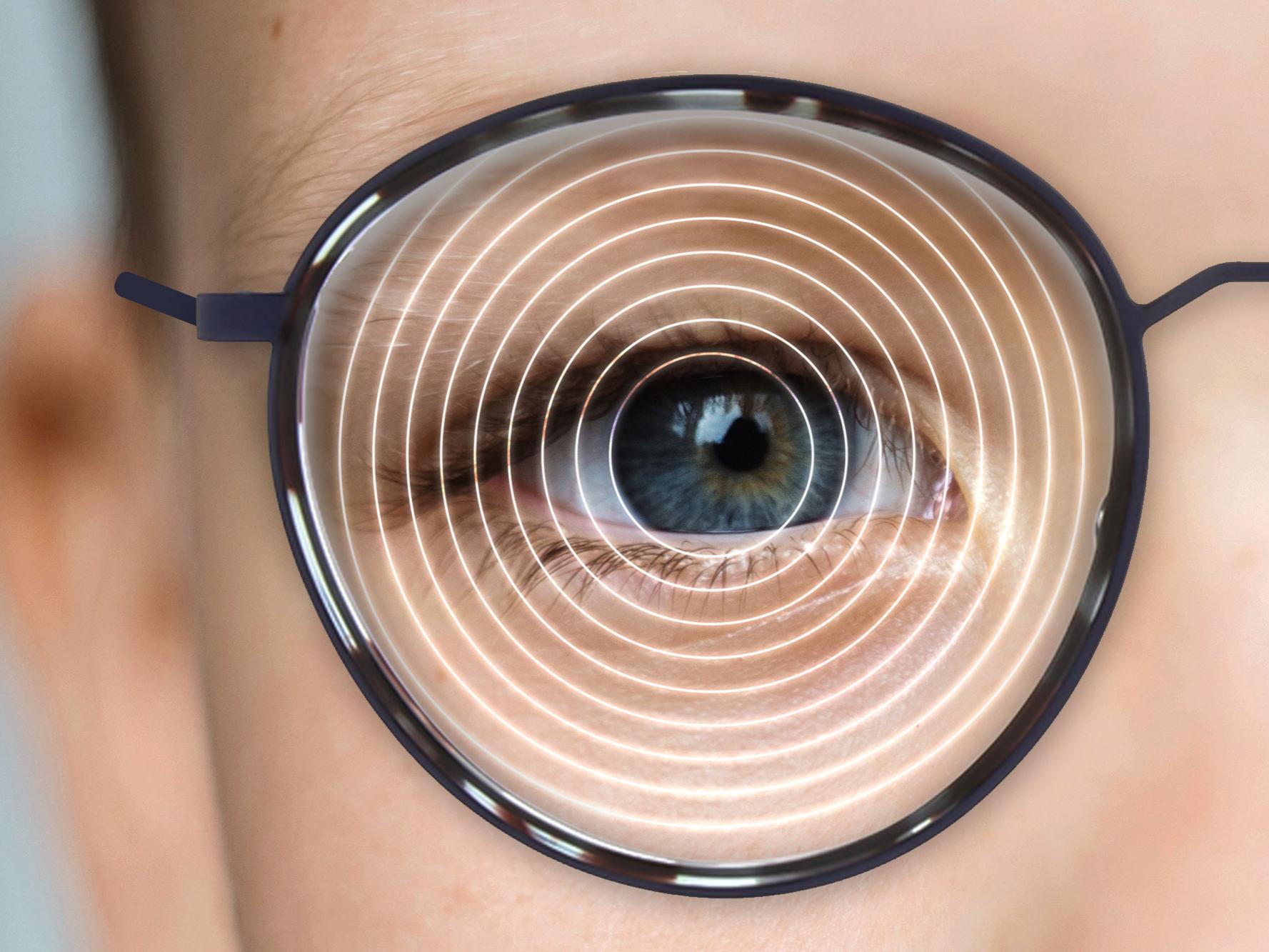 Schematic illustration of the ZEISS MyoVision Ace lens design: a small but sufficient central zone offers distance vision support and the outer parts address myopia progression