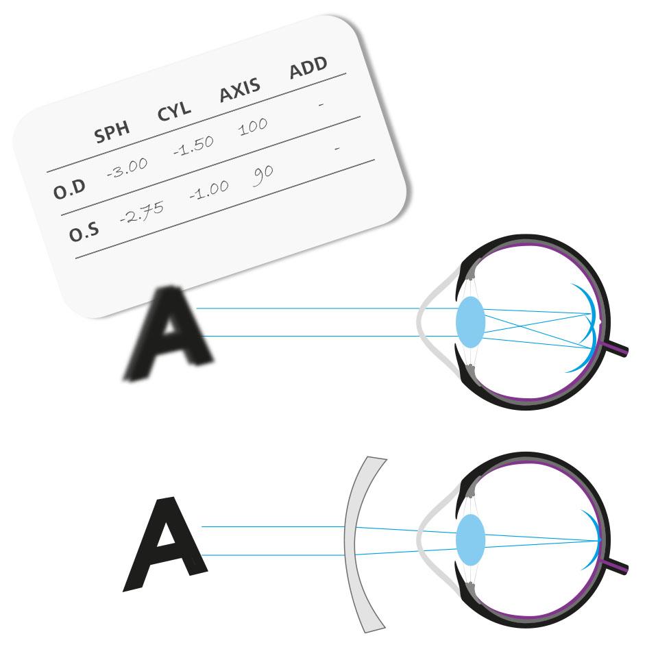 How glasses correct vision hot sale