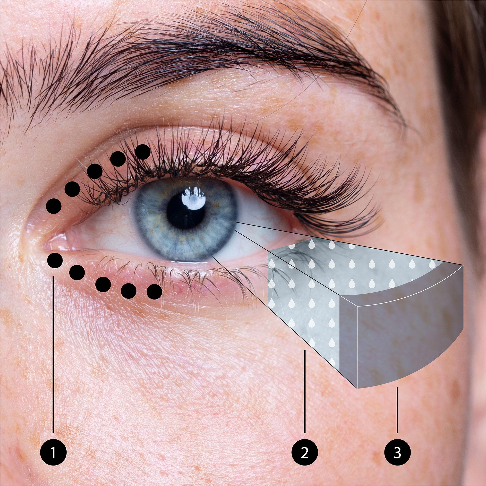 An image of an eye, showing the position of the meibomian glands in the eye lids and meibum layer on top of the tear fluid over the eye.