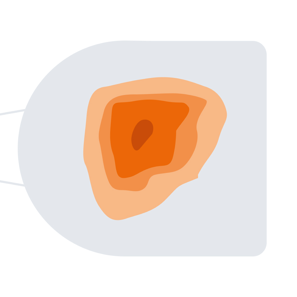 An illustration of ZEISS Warm Eye Mask’s heat distribution compared to conventional warm eye masks, which distribute heat less evenly.