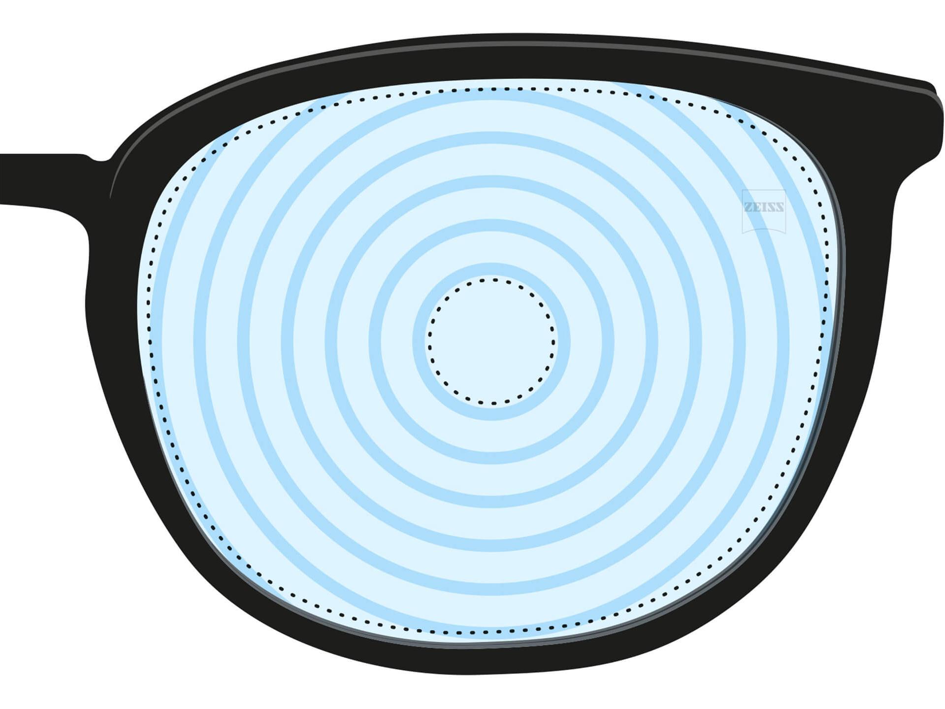 近視コントロールをするメガネレンズのイラスト。レンズには、異なるレンズ強度を示す、同心円があります。これは、特殊な目的のために設計したレンズの一例です。