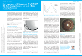 Preview image of Early experience with the aspheric CT LUCIA 621P IOL.
