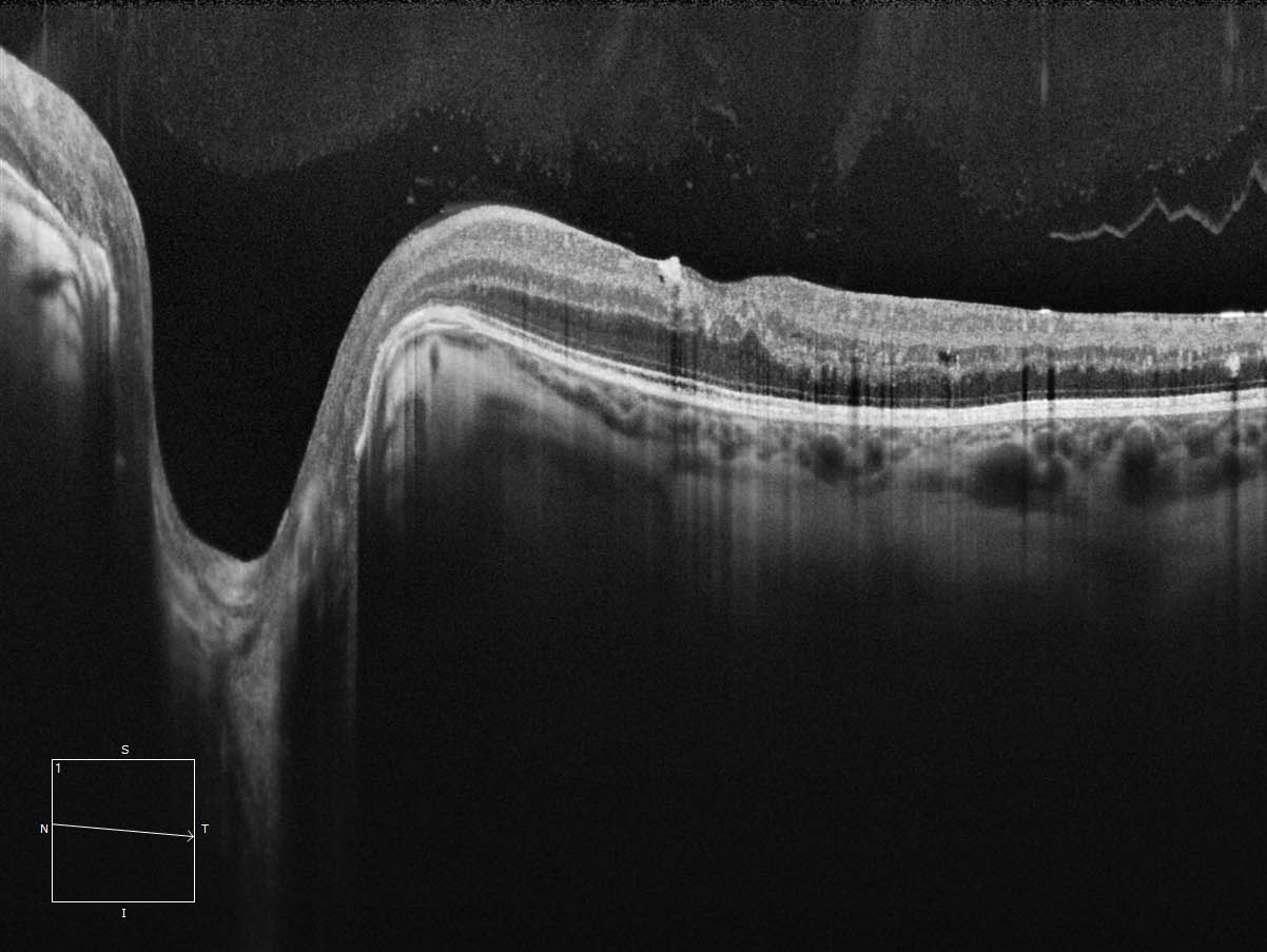 ZEISS Retina Fast imaging, without compromise