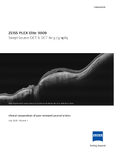 Vista previa de imagen de Angio-OCT y tomógrafo de coherencia óptica (OCT) Swept-Source PLEX Elite 9000