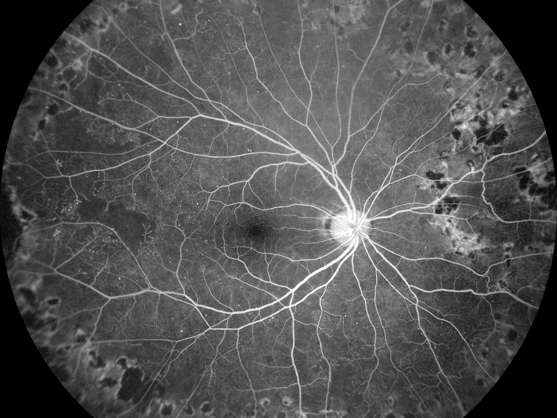 ZEISS Retina Seeing wider and deeper