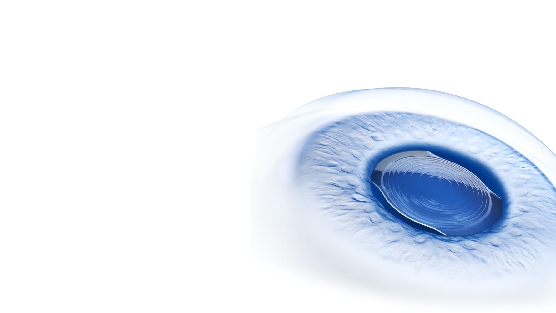 ZEISS Premium cataract workflow