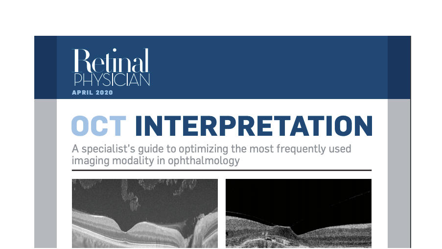 OCT Interpretation, Retinal Physician April 2020