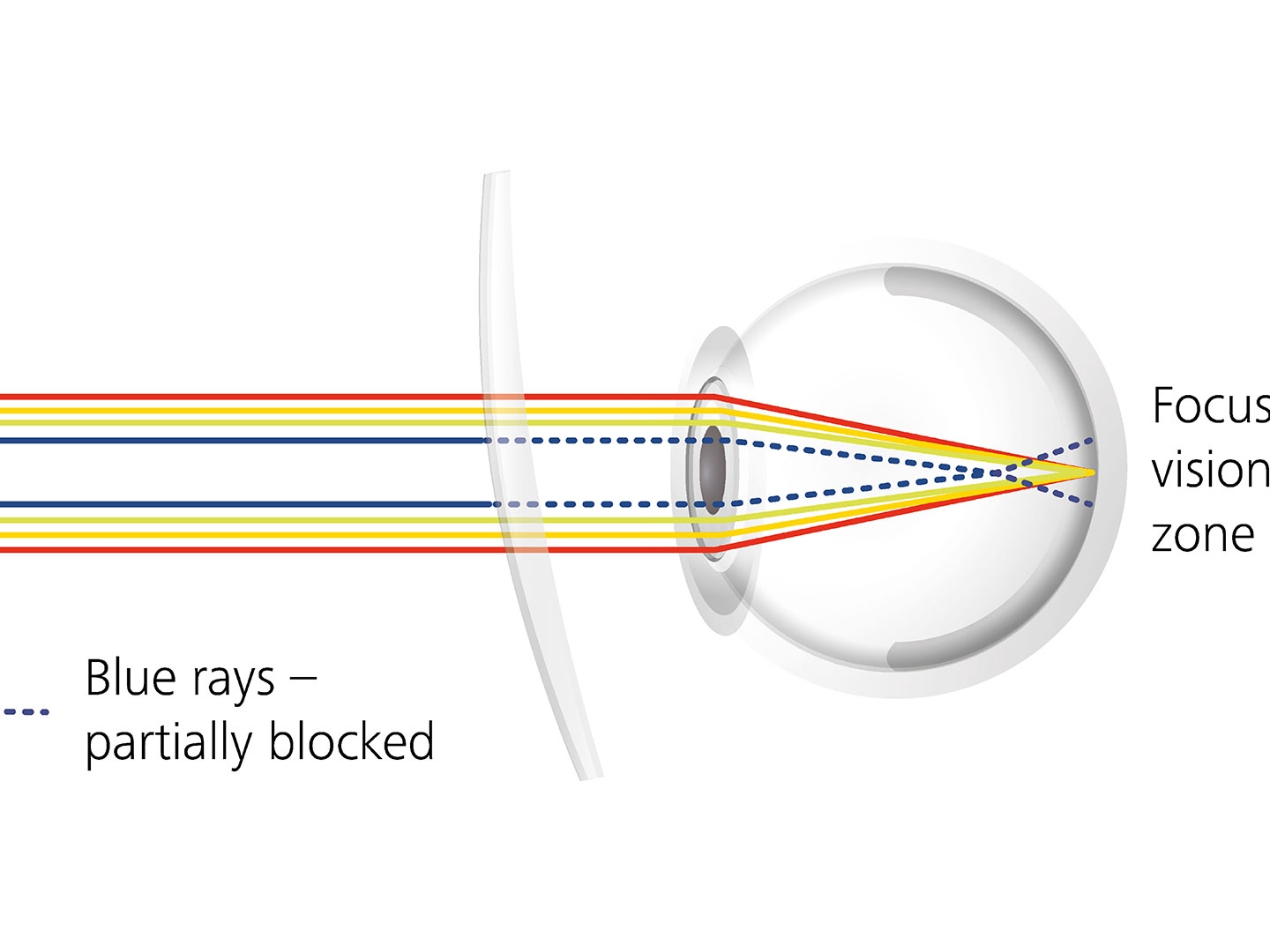 Показано, как покрытие линзы уменьшает блики за счет частичной блокировки синих лучей. 