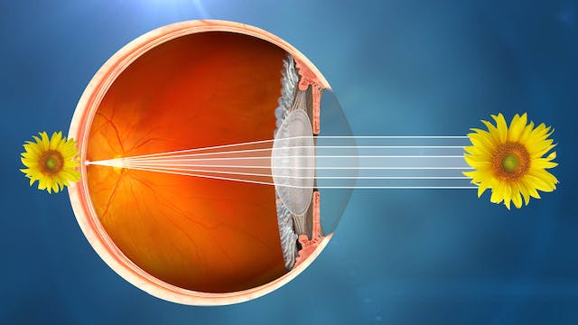 Illustrative visualization of an healthy eye.